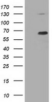 PKLR Antibody - HEK293T cells were transfected with the pCMV6-ENTRY control (Left lane) or pCMV6-ENTRY PKLR (Right lane) cDNA for 48 hrs and lysed. Equivalent amounts of cell lysates (5 ug per lane) were separated by SDS-PAGE and immunoblotted with anti-PKLR.