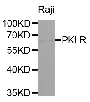 PKLR Antibody - Western blot analysis of extracts of Raji cells.