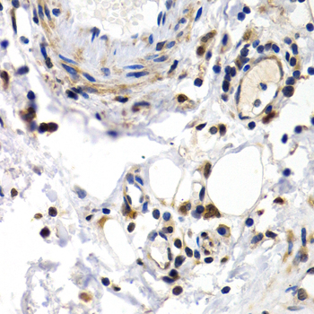 PKLR Antibody - Immunohistochemistry of paraffin-embedded human normal colon tissue.
