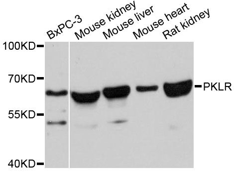 PKLR Antibody - Western blot analysis of extracts of various cell lines, using PKLR antibody at 1:3000 dilution. The secondary antibody used was an HRP Goat Anti-Rabbit IgG (H+L) at 1:10000 dilution. Lysates were loaded 25ug per lane and 3% nonfat dry milk in TBST was used for blocking. An ECL Kit was used for detection and the exposure time was 50s.