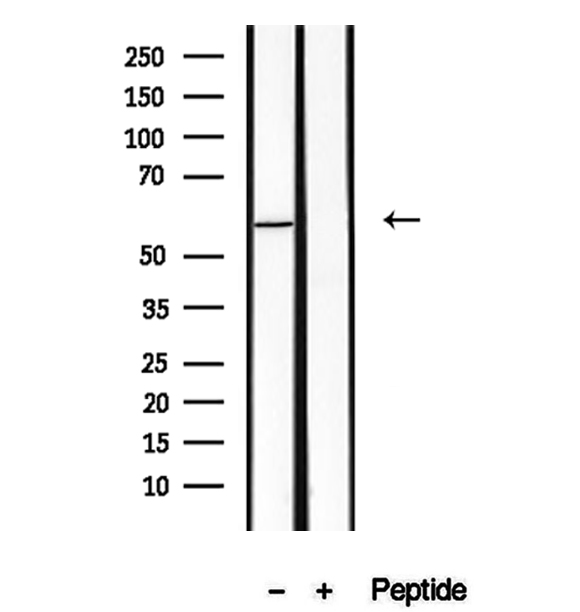PKLR Antibody - Western blot analysis of extracts of MCF-7 cells using PKLR antibody.