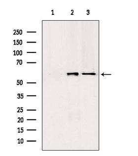 PKLR Antibody - Western blot analysis of extracts of various samples using PKLR antibody. Lane 1: mouse brain treated with blocking peptide. Lane 2: mouse brain; Lane 3: HeLa;