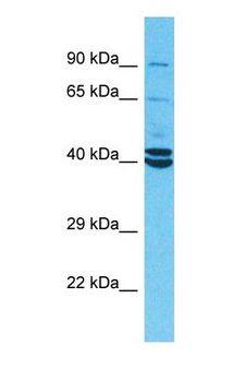 PKLR Antibody - Western blot of PKLR Antibody with human NCI-H226 Whole Cell lysate.  This image was taken for the unconjugated form of this product. Other forms have not been tested.