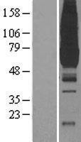 PKLR Protein - Western validation with an anti-DDK antibody * L: Control HEK293 lysate R: Over-expression lysate