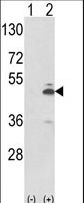PKM / Pyruvate Kinase, Muscle Antibody - Western blot of PKM2 (arrow) using rabbit polyclonal PKM2 Antibody (N-term E131). 293 cell lysates (2 ug/lane) either nontransfected (Lane 1) or transiently transfected with the PKM2 gene (Lane 2).