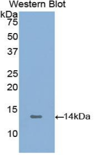 PKM / Pyruvate Kinase, Muscle Antibody - Western blot of recombinant PKM / Pyruvate Kinase.  This image was taken for the unconjugated form of this product. Other forms have not been tested.