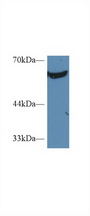 PKM / Pyruvate Kinase, Muscle Antibody - Western Blot; Sample: Human K562 cell lysate; Primary Ab: 2µg/ml Rabbit Anti-Human PKM2 Antibody Second Ab: 0.2µg/mL HRP-Linked Caprine Anti-Rabbit IgG Polyclonal Antibody