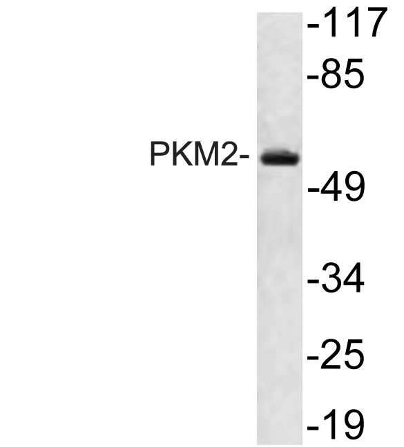 PKM / Pyruvate Kinase, Muscle Antibody - Western blot analysis of lysate from HT29 cells, using PKM2 antibody.