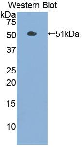 PKM / Pyruvate Kinase, Muscle Antibody - Western blot of PKM2 antibody.