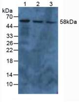 PKM / Pyruvate Kinase, Muscle Antibody - Western Blot; Sample: Lane1: Human A549 Cells; Lane2: Human HepG2 Cells; Lane3: Human Hela Cells.