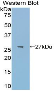 PKM / Pyruvate Kinase, Muscle Antibody - Western blot of recombinant PKM / Pyruvate Kinase.  This image was taken for the unconjugated form of this product. Other forms have not been tested.
