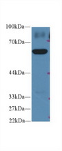 PKM / Pyruvate Kinase, Muscle Antibody - Western Blot; Sample: Human HepG2 cell lysate; Primary Ab: 2µg/ml Rabbit Anti-Rat PKM2 Antibody Second Ab: 0.2µg/mL HRP-Linked Caprine Anti-Rabbit IgG Polyclonal Antibody