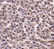 PKM / Pyruvate Kinase, Muscle Antibody - PKM2 Antibody - IHC of PKM2 in liver tissue.  This image was taken for the unconjugated form of this product. Other forms have not been tested.
