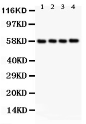 PKM / Pyruvate Kinase, Muscle Antibody - PKM2 antibody Western blot. All lanes: Anti PKM2 at 0.5 ug/ml. Lane 1: MCF-7 Whole Cell Lysate at 40 ug. Lane 2: MM231 Whole Cell Lysate at 40 ug. Lane 3: MM453 Whole Cell Lysate at 40 ug. Lane 4: HELA Whole Cell Lysate at 40 ug. Predicted band size: 58 kD. Observed band size: 58 kD.