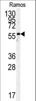 PKM / Pyruvate Kinase, Muscle Antibody - Western blot of anti-h PKM2-N491 antibody in Ramos cell line lysates (35 ug/lane). hPKM2-N491(arrow) was detected using the purified antibody.