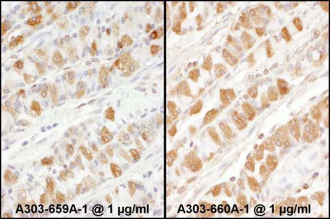 PKM / Pyruvate Kinase, Muscle Antibody - Detection of Human PKM2 by Immunohistochemistry. Samples: FFPE sections of human stomach. Antibody: Affinity purified rabbit anti-PKM2 used at a dilution of 1:1000. Detection: DAB.