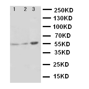 PKM / Pyruvate Kinase, Muscle Antibody - WB of PKM / Pyruvate Kinase antibody. Lane 1: HELA Cell Lysate. Lane 2: MCF-7 Cell Lysate. Lane 3: A549 Cell Lysate..