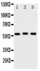 PKM / Pyruvate Kinase, Muscle Antibody - Anti-PKM2 antibody, Western blotting Lane 1: HELA Cell LysateLane 2: MCF-7 Cell LysateLane 3: A549 Cell Lysate