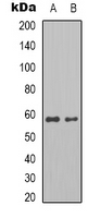PKM / Pyruvate Kinase, Muscle Antibody - Western blot analysis of Pyruvate Kinase expression in MCF7 (A); HepG2 (B) whole cell lysates.