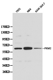 PKM / Pyruvate Kinase, Muscle Antibody - Western blot of PKM2 pAb in extracts from 7901, NB4 and Raw264.7 cells.