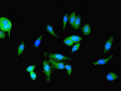 PKM / Pyruvate Kinase, Muscle Antibody - Immunofluorescent analysis of Hela cells using PKM Antibody at dilution of 1:100 and Alexa Fluor 488-congugated AffiniPure Goat Anti-Rabbit IgG(H+L)