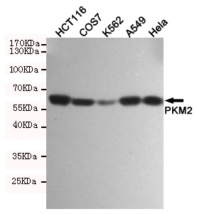 PKM / Pyruvate Kinase, Muscle Antibody - Western blot detection of PKM2 in HCT116, COS7, K562, A549 and HeLa cell lysates using PKM2 mouse monoclonal antibody (1:1000 dilution). Predicted band size: 60KDa. Observed band size:60KDa.