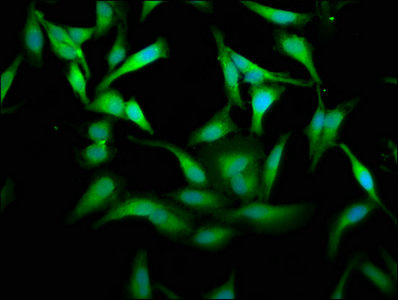 PKM / Pyruvate Kinase, Muscle Antibody - Immunofluorescence staining of Hela cells with PKM Antibody at 1:175, counter-stained with DAPI. The cells were fixed in 4% formaldehyde, permeabilized using 0.2% Triton X-100 and blocked in 10% normal Goat Serum. The cells were then incubated with the antibody overnight at 4°C. The secondary antibody was Alexa Fluor 488-congugated AffiniPure Goat Anti-Rabbit IgG(H+L).