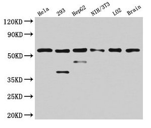 PKM / Pyruvate Kinase, Muscle Antibody - Western Blot Positive WB detected in: Hela whole cell lysate, Mouse brain tissue All lanes: PKM antibody at 4.5µg/ml Secondary Goat polyclonal to rabbit IgG at 1/50000 dilution Predicted band size: 58, 59, 57 kDa Observed band size: 58 kDa