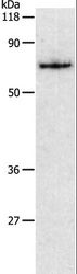 PKM / Pyruvate Kinase, Muscle Antibody - Western blot analysis of HeLa cell, using PKM2 Polyclonal Antibody at dilution of 1:450.