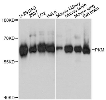PKM / Pyruvate Kinase, Muscle Antibody - Western blot analysis of extracts of various cell lines, using PKM antibody at 1:1000 dilution. The secondary antibody used was an HRP Goat Anti-Rabbit IgG (H+L) at 1:10000 dilution. Lysates were loaded 25ug per lane and 3% nonfat dry milk in TBST was used for blocking. An ECL Kit was used for detection and the exposure time was 1s.