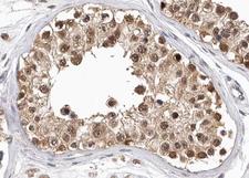 PKM / Pyruvate Kinase, Muscle Antibody - 1:100 staining human Testis tissue by IHC-P. The tissue was formaldehyde fixed and a heat mediated antigen retrieval step in citrate buffer was performed. The tissue was then blocked and incubated with the antibody for 1.5 hours at 22°C. An HRP conjugated goat anti-rabbit antibody was used as the secondary.