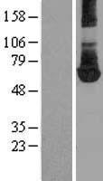 PKM / Pyruvate Kinase, Muscle Protein - Western validation with an anti-DDK antibody * L: Control HEK293 lysate R: Over-expression lysate