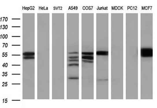 PKM2 Antibody - Western blot of extracts (35ug) from 9 different cell lines by using anti-PKM2 monoclonal antibody at 1:200 (HepG2: human; HeLa: human; SVT2: mouse; A549: human; COS7: monkey; Jurkat: human; MDCK: canine; PC12: rat; MCF7: human).