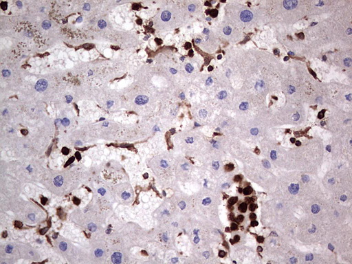 PKM2 Antibody - IHC of paraffin-embedded Human liver tissue using anti-PKM2 mouse monoclonal antibody.