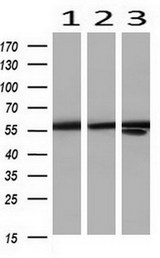 PKM2 Antibody - Western blot of extracts (35ug) from 3 different cell lines by using anti-PKM2 monoclonal antibody at 1:200 (1: SVT2; 2: MDCK; 3: PC12).