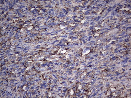 PKM2 Antibody - IHC of paraffin-embedded Human Ovary tissue using anti-PKM2 Mouse monoclonal antibody.