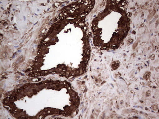 PKM2 Antibody - IHC of paraffin-embedded Human prostate tissue using anti-PKM2 mouse monoclonal antibody.