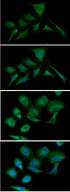 PKM2 Antibody - ICC/IF analysis of PKM2 in HeLa cells line, stained with DAPI (Blue) for nucleus staining and monoclonal anti-human PKM2 antibody (1:100) with goat anti-mouse IgG-Alexa fluor 488 conjugate (Green).ICC/IF analysis of PKM2 in A549 cells line, stained with DAPI (Blue) for nucleus staining and monoclonal anti-human PKM2 antibody (1:100) with goat anti-mouse IgG-Alexa fluor 488 conjugate (Green).