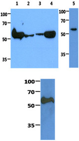 PKM2 Antibody - Fig.1: The cell lysates (40ug) were resolved by SDS-PAGE, transferred to PVDF membrane and probed with anti-human PKM2 antibody (1:1000). Proteins were visualized using a goat anti-mouse secondary antibody conjugated to HRP and an ECL detection system. Lane 1 : HeLa cell lysate Lane 2 : Jurkat cell lysate Lane 3 : MCF7 cell lysate Lane 4 : A549 cell lysate Lane 5 : 293T cell lysate Fig 2: The Recombinant human PKM2 (50ng) protein was resolved by SDS-PAGE, transferred to PVDF membrane and probed with anti-human PKM2 antibody (1:1000). Proteins were visualized using a goat anti-mouse secondary antibody conjugated to HRP and an ECL detection system.