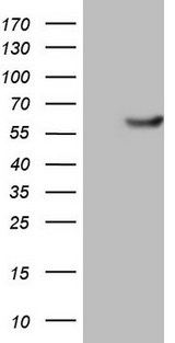 PKM2 Antibody - HEK293T cells were transfected with the pCMV6-ENTRY control (Left lane) or pCMV6-ENTRY PKM2 (Right lane) cDNA for 48 hrs and lysed. Equivalent amounts of cell lysates (5 ug per lane) were separated by SDS-PAGE and immunoblotted with anti-PKM2.