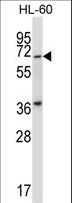 PKMYT1 Antibody - Mouse Pkmyt1 Antibody western blot of HL-60 cell line lysates (35 ug/lane). The Pkmyt1 antibody detected the Pkmyt1 protein (arrow).