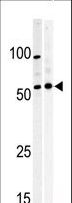 PKMYT1 Antibody - Western blot of anti-PKMYT1 Pabin A375(left) and Y79 (right)cell line lysate. PKMYT1(arrow) was detected using the purified antibody.