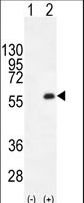 PKMYT1 Antibody - Western blot of PKMYT1 (arrow) using rabbit polyclonal PKMYT1 C-term. 293 cell lysates (2 ug/lane) either nontransfected (Lane 1) or transiently transfected (Lane 2) with the PKMYT1 gene.