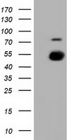 PKMYT1 Antibody - HEK293T cells were transfected with the pCMV6-ENTRY control (Left lane) or pCMV6-ENTRY PKMYT1 (Right lane) cDNA for 48 hrs and lysed. Equivalent amounts of cell lysates (5 ug per lane) were separated by SDS-PAGE and immunoblotted with anti-PKMYT1.