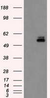 PKMYT1 Antibody - HEK293T cells were transfected with the pCMV6-ENTRY control (Left lane) or pCMV6-ENTRY PKMYT1 (Right lane) cDNA for 48 hrs and lysed. Equivalent amounts of cell lysates (5 ug per lane) were separated by SDS-PAGE and immunoblotted with anti-PKMYT1.