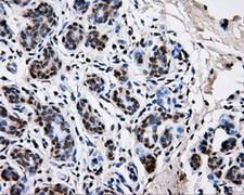 PKMYT1 Antibody - IHC of paraffin-embedded breast tissue using anti-PKMYT1 mouse monoclonal antibody. (Dilution 1:50).