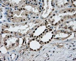 PKMYT1 Antibody - IHC of paraffin-embedded Kidney tissue using anti-PKMYT1 mouse monoclonal antibody. (Dilution 1:50).