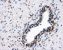 PKMYT1 Antibody - IHC of paraffin-embedded prostate tissue using anti-PKMYT1 mouse monoclonal antibody. (Dilution 1:50).