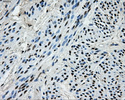 PKMYT1 Antibody - IHC of paraffin-embedded endometrium tissue using anti-PKMYT1 mouse monoclonal antibody. (Dilution 1:50).