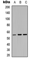 PKMYT1 Antibody - Western blot analysis of MYT1 expression in HepG2 (A); K562 (B); NIH3T3 (C) whole cell lysates.